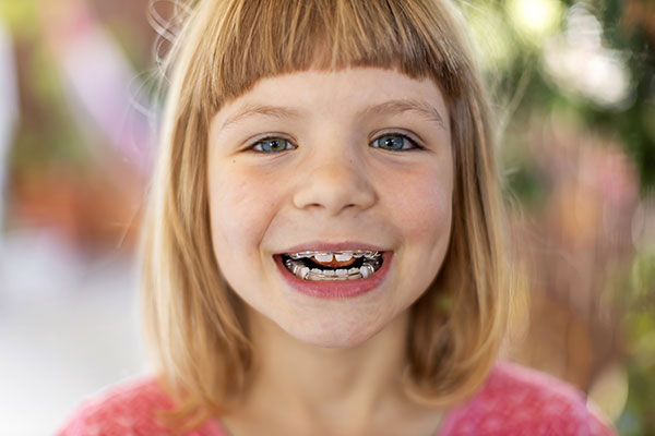 Chelmsford Early Orthodontic Treatment