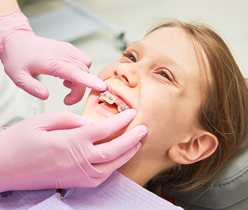 Orthodontic Associates of New England | Adult Treatment, Early Treatment and Common Treatments