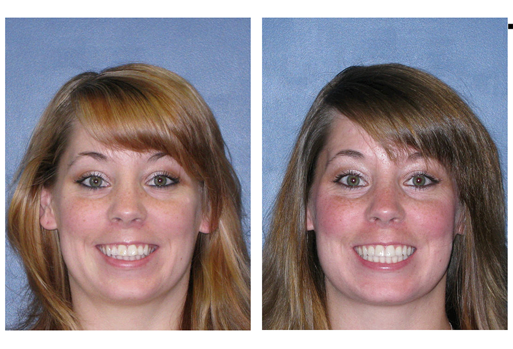 Orthodontic Associates of New England