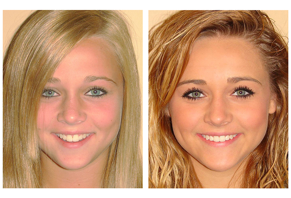 Orthodontic Associates of New England