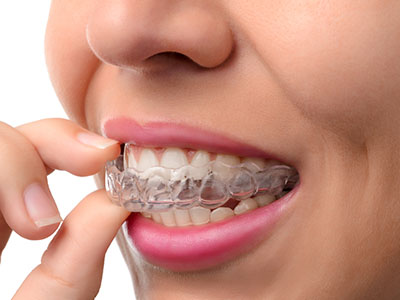 Orthodontic Associates of New England | Early Treatment, Invisalign reg  and Adult Treatment